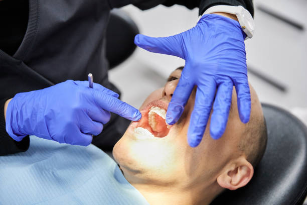 Best Emergency Wisdom Teeth Removal in Chelsea, MI